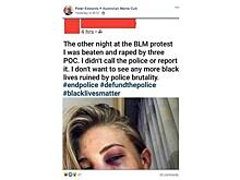 Звезду российских ММА и «Матч ТВ» используют для разжигания ненависти