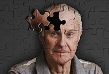 Ученые составили рейтинг факторов риска болезни Альцгеймера