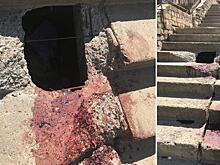 Аварийная лестница у кировского УФАС стала причиной черепно-мозговой травмы прохожего