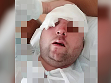 «Муж лежал в луже крови»: в Брагино жестоко избили двух женщин и мужчину