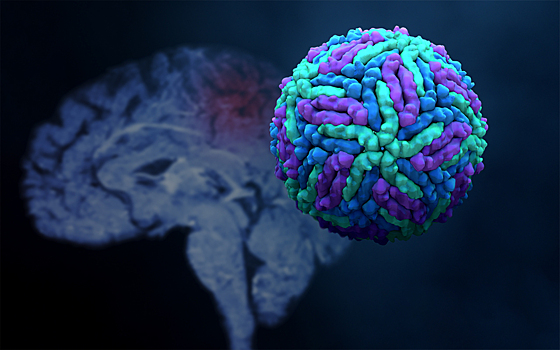 Вирус Зика приводит к поражению мозга и расстройствам памяти