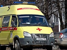 В Башкирии 35-летний мужчина лишился части руки на работе