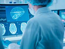 Обнаружена неожиданная причина развития психических заболеваний