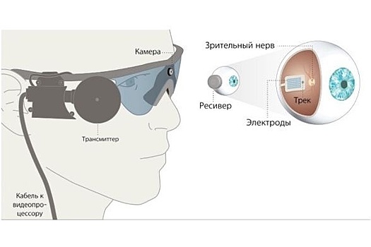 Челябинцу вживили бионический глаз