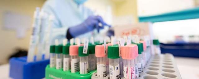 Во Владимирской области 28 января коронавирус выявили еще у 28 человек