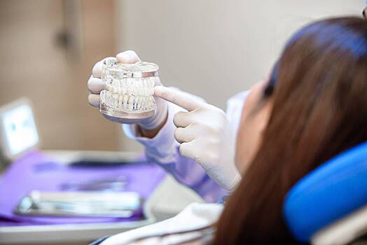 Россиянам объяснили правила ухода за зубными имплантами