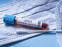 Пандемия пока не отменяется: за последний месяц зарегистрировано 3 миллиона случаев COVID-19