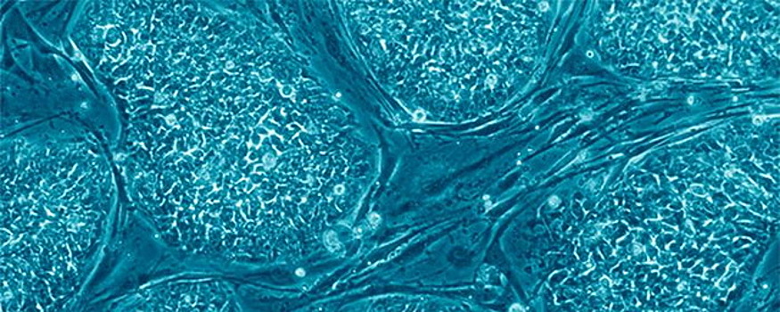 Ученые: стволовые клетки способны откладывать собственную смерть