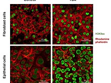 Вещество с противогрибковой активностью поспособствовало уменьшению фиброза почечной ткани