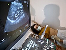 Профессор кафедры биоэтики объяснила заинтересованность людей в процедуре ЭКО