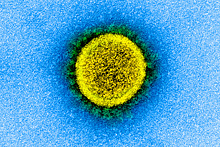Испытания вакцин против коронавируса раскритиковали