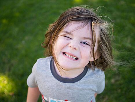 Стоматолог: если ребенок выбил зуб, его нужно положить в молоко