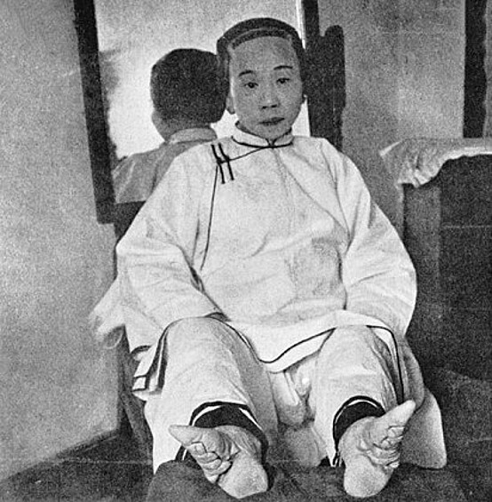 В X веке в Китае размер ноги девушки являлся важным условием при заключении брака. Завидной невестой считалась та китаянка, чья ступня была меньше 10 сантиметров в длину. Естественно, что таким размером ноги могли похвастаться немногие девушки. Поэтому родители были вынуждены идти на крайние меры, чтобы обеспечить своим дочерям счастливое будущее.