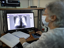 Врач-пульмонолог назвал способы лечения сухого кашля