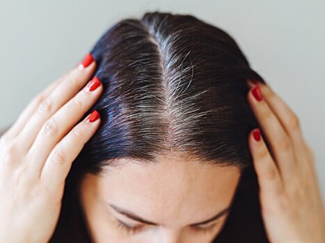 Трихолог Егорова назвала причину облысения российских подростков