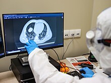 Насколько опасна бессимптомная форма COVID-19?