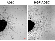 Клеточные пластыри восстановят ткань после ишемии