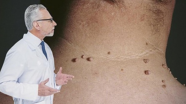 В борьбе с коварным врагом хороши любые методы. Действенные лекарства с полей и огородов!