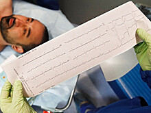 Какие болезни сердца вызывают лекарства от COVID-19