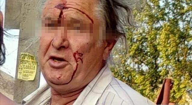 В Новороссийске на улице незнакомый мужчина ударил 11-летнюю девочку кулаком в лицо