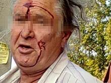 В Новороссийске на улице незнакомый мужчина ударил 11-летнюю девочку кулаком в лицо