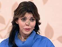 Экс-супруга Аршавина сделала очередную пластику носа