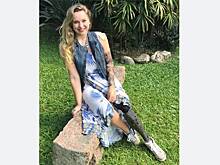 Туристка-студентка упала на рельсы метро и лишилась конечностей