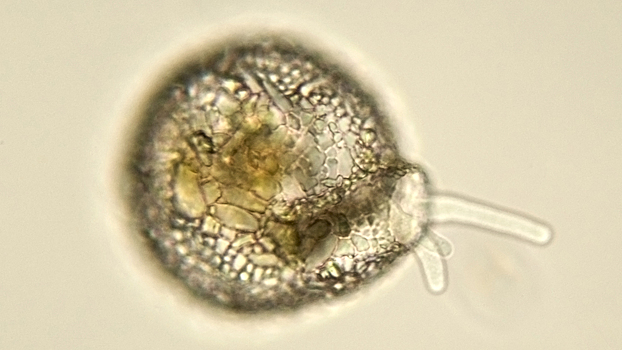 Коварный микроорганизм может погубить человечество