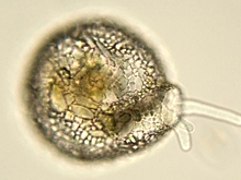 Коварный микроорганизм может погубить человечество