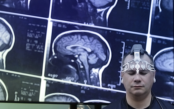 Космические полеты повлияли на объем мозга космонавтов