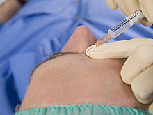 Роспотребнадзор рекомендовал воздержаться от ботокса после прививки от COVID-19