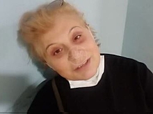 Вдове Арцибашева плеснули кислотой в лицо
