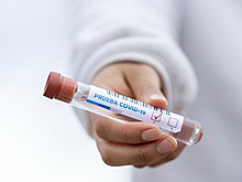 В России может быть создана самая быстрая тест-система выявления COVID-19