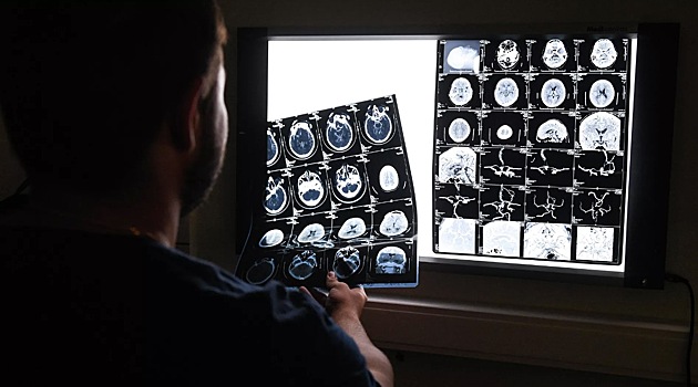 В России синтезировали новый препарат против болезни Альцгеймера