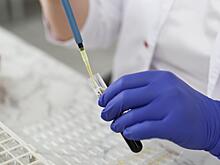 Анализ на вирус папилломы стал доступен по ОМС