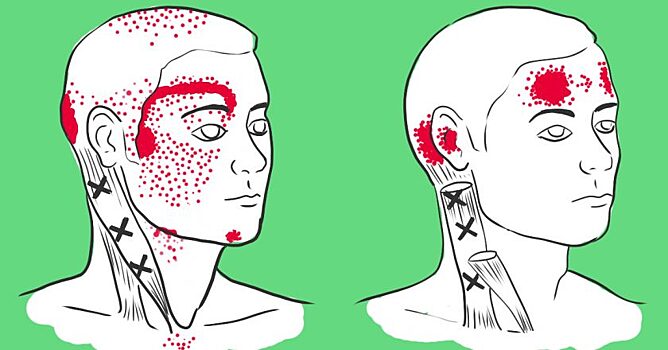 Нехватка этих продуктов вызывает головную боль. Жаль, что не знала об этом раньше!