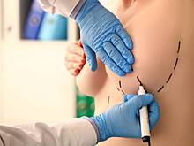 Российская клиника ответила на обвинение в публикации обнаженных снимков пациентки