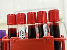 Смертность от COVID-19 предложили снизить разжижением крови