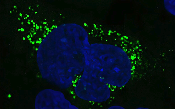 ИИ-инструмент смог найти скрытые белки в «тёмных» участках ДНК