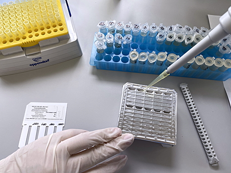 Оспа обезьян: симптомы, признаки, чем опасно заболевание