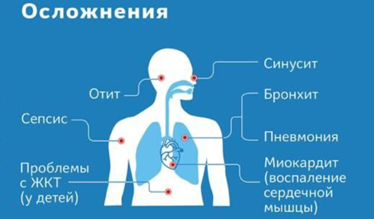 Перенесенная короновирусная инфекция. Осложнения при коронавирусе. Короновирусная инфекция осложнения. Симптомы и осложнения коронавируса.