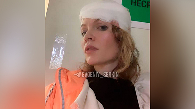 Актриса Стебунова упала со сцены в театре и повредила челюсть
