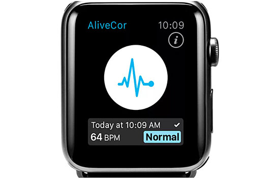 Для Apple Watch появился браслет, диагностирующий гиперкалиемию