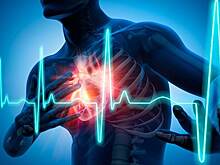 Разработан новый способ предотвращения атеросклероза, инфаркта и инсульта