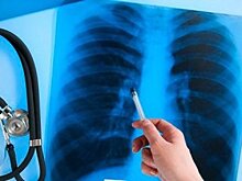 Парламент Башкирии вводит новые понятия для возможных больных туберкулезом