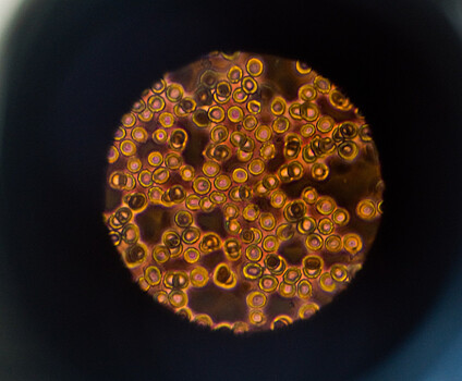 Неизвестную науке инфекцию обнаружили в Африке