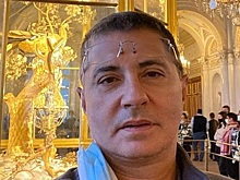 Мясников сравнил эпидемию ожирения с пандемией коронавируса