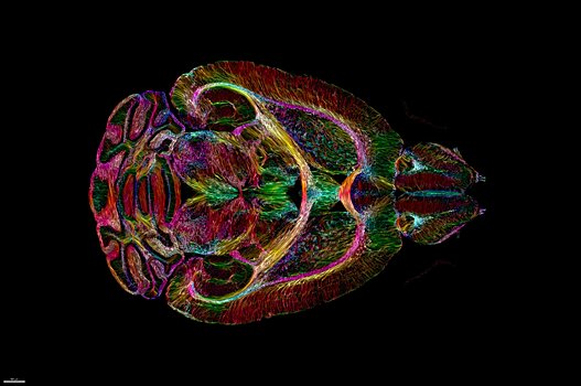 Учёные получили в 64 млн раза более четкое изображение мозга мыши