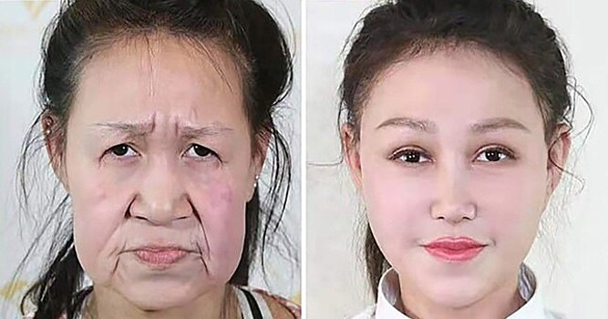 Выглядевшей на 60 девочке-подростку обновили лицо