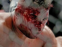 Боец UFC «станцевал локтями» на лице соперника. Последствия ужасают